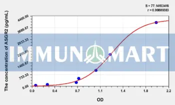 Human ASGR2(Asialoglycoprotein Receptor 2) ELISA Kit