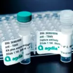 Reagent Set for Prune dwarf virus (PDV)