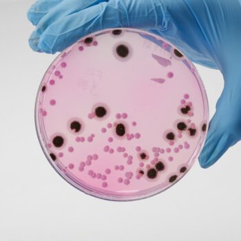 HiMedia GM1000 - distributed by Immunomart