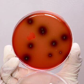 HiMedia GM1064 - distributed by Immunomart