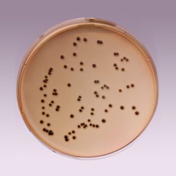 HiMedia GM108 - distributed by Immunomart
