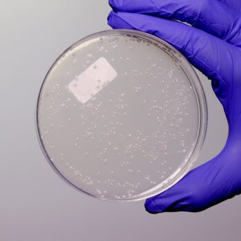 HiMedia GM1129 - distributed by Immunomart