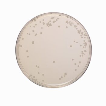 HiMedia GM933 - distributed by Immunomart