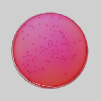 HiMedia M031 - distributed by Immunomart