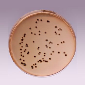 HiMedia M1032 - distributed by Immunomart