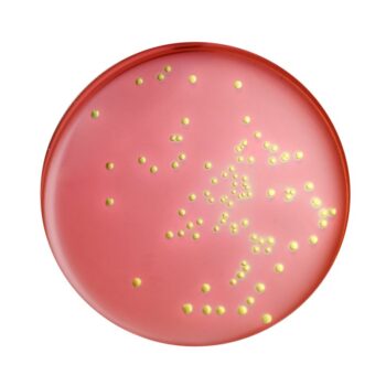 HiMedia M301 - distributed by Immunomart