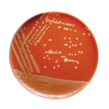 HiMedia M434 - distributed by Immunomart