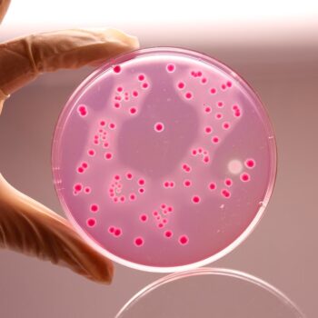 HiMedia M581 - distributed by Immunomart