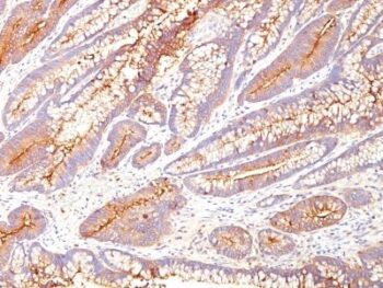 CD66 (CEA)(COL-1), 1mg/mL
