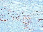 Calgranulin B / MRP-8/-14 / MAC 387 / S100A8/A9 / Macrophage Ag(MAC387), CF640R conjugate, 0.1mg/mL 1 BNUB0035-0-1
