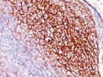 CD35 / CR1(E11), 0.2mg/mL