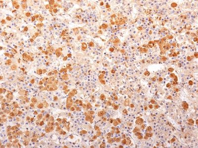 BNUB0139 0 1- Immunomart