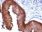 Cytokeratin 17(E3), 0.2mg/mL 1 BNUB0158-0-1