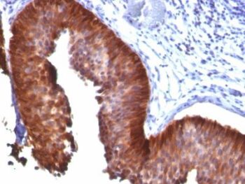 Cytokeratin 17(E3), CF640R conjugate, 0.1mg/mL