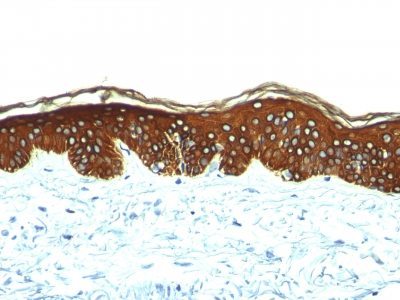 BNUB0257-0-1 BNUB0257 0 1- Immunomart