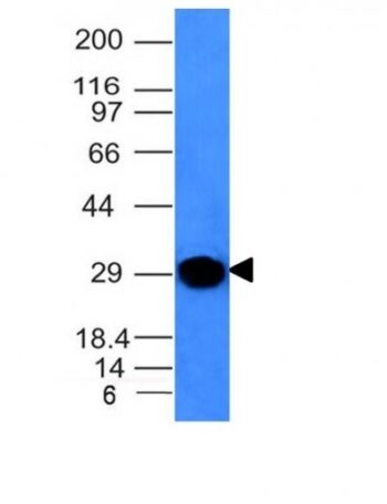 Human Kappa Light Chain(KLC264), 0.2mg/mL