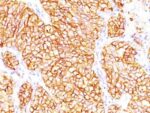 Renal Cell Carcinoma (Carbonic Anhydrase IX)(66.4.C2), Biotin conjugate, 0.1mg/mL 1 BNUB0287-0-1