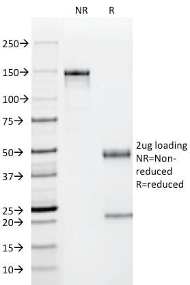 p53(PAb122), 1mg/mL