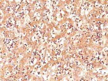AFP (Alpha Fetoprotein)(C3), CF568 conjugate, 0.1mg/mL