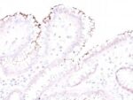 Helicobacter pylori(Rabbit PAb), CF640R conjugate, 0.1mg/mL
