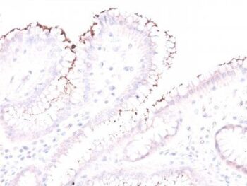 Helicobacter pylori(Rabbit PAb), CF640R conjugate, 0.1mg/mL