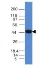 Cytokeratin 8(K8/383), CF640R conjugate, 0.1mg/mL 1 BNUB0383-0-1
