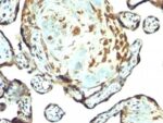 TIMP3(Rabbit PAb), CF640R conjugate, 0.1mg/mL
