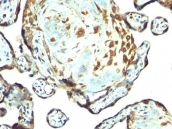TIMP3(Rabbit PAb), CF640R conjugate, 0.1mg/mL
