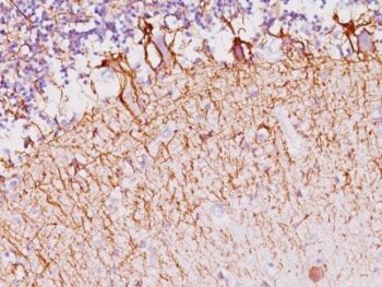Neurofilament (NF-H)(NF421), CF740 conjugate, 0.1mg/mL