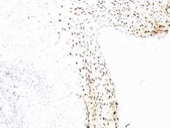 Human Papillomavirus 16 (HPV-16)(CAMVIR-1), 0.2mg/mL