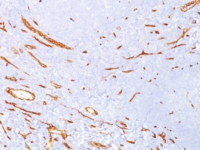 BNUB0640-0-1 BNUB0640 0 1- Immunomart