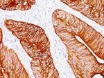 Cytokeratin 8(K8.8), CF594 conjugate, 0.1mg/mL 1 BNUB0689-0-1