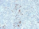 Kappa Light Chain(TB28-2), 1mg/mL