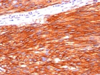 VEGFR2 / Flk-1 / KDR3 / CD309(KDR721), 0.2mg/mL