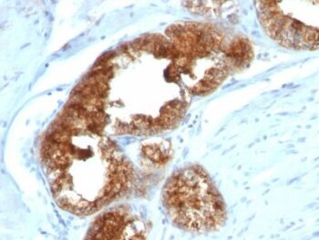 TAG-72 / CA72.4(B72.3 + CA72/733), CF594 conjugate, 0.1mg/mL