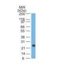 Human Lambda Light Chain(LcN-2 + ICO-106), CF568 conjugate, 0.1mg/mL