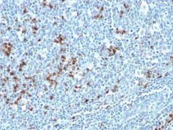 Human Kappa Light Chain(HP6053 + L1C1), CF740 conjugate, 0.1mg/mL