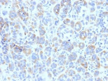 TRP1 (Tyrosinase Related Protein 1)(TYRP1/807), 1mg/mL