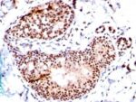 TRP1 (Tyrosinase Related Protein 1) (TA99 + TYRP1/807), 1mg/mL