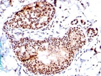 TRP1 (Tyrosinase Related Protein 1) (TA99 + TYRP1/807), 1mg/mL