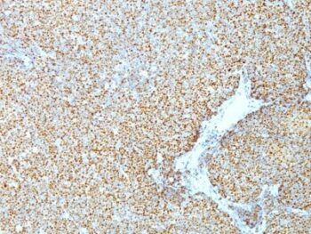 Cyclin D1(CCND1/809), CF555 conjugate, 0.1mg/mL