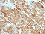 Tyrosinase(OCA1/812), 1mg/mL