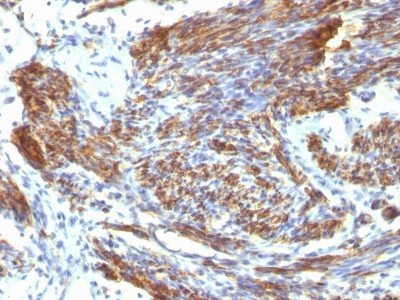 BNUB0820-0-1 BNUB0820 0 1- Immunomart