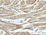 Caldesmon, HMW (h-Caldesmon)(CALD1/820 + h-CALD), CF594 conjugate, 0.1mg/mL