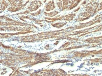 Caldesmon, HMW (h-Caldesmon)(CALD1/820 + h-CALD), CF594 conjugate, 0.1mg/mL