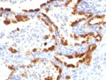 Cytokeratin 18(KRT18/835), 0.2mg/mL 1 BNUB0835