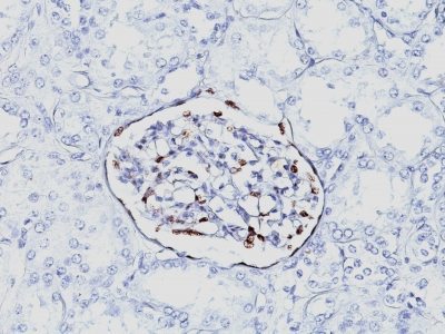 BNUB0856 0 1- Immunomart