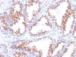 Androgen Receptor(DHTR/882), CF640R conjugate, 0.1mg/mL