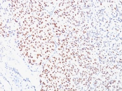 BNUB0892 0 1- Immunomart