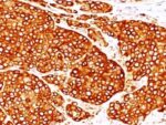 Tyrosinase(T311 + OCA1/812), CF740 conjugate, 0.1mg/mL 1 BNUB0908-0-1
